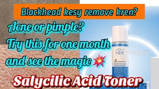 Honest Review of most viral Salycilic acid Toner#honestReview#blackheads#acne