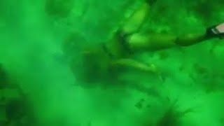 Female Snorkler Bitten By Moray Eel