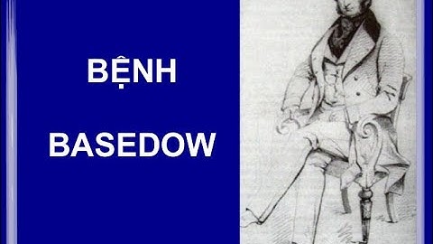 Basedow có phải bệnh Bướu Cổ?