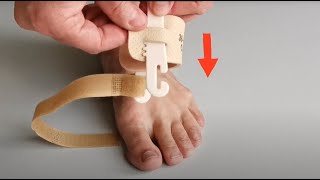 svorto® | 030 Bandáž noční Hallux valgus | jak umístit na nohu | úprava velikosti