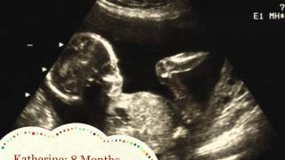 Prenatal Development CAD 210