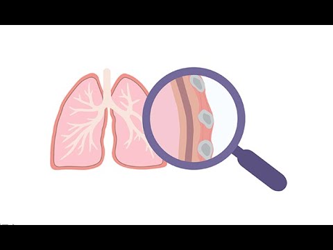 How to interpret lung ultrasound in COVID 19 and other diseases (SARS-CoV-2, Coronavirus)