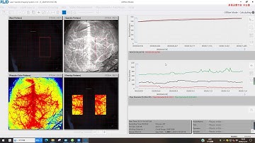 The function of LSCI with off Line Model