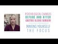 Psychological Changes Before + After Gastric Sleeve:  Making Yourself the Focus #gastricsleeve