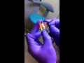 Детская стоматология: пластинка для детей (для зубов)