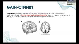 GAIN trial: A phase I/II open-label clinical trial in patients with CTNNB1 Syndrome