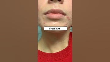 6 signs your period is coming 😬♥️ #music #periods #girl  #cramps