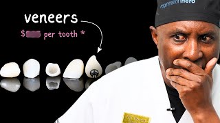Why your fillings and veneers cost that much | Dental Bonding