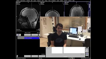 layer fMRI tutorial on setting up high-resolution EPI acquisition
