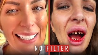 The Horrible Truth Behind My 'Turkey Teeth' | No Filter | @LADbible Resimi