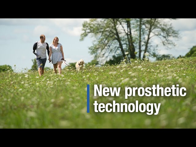 Latest advance in prosthetics is helping some patients regain