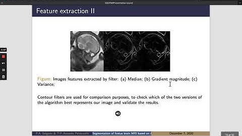Segmentation of foetus brain MRI  based on K-nn algorithm, a case study