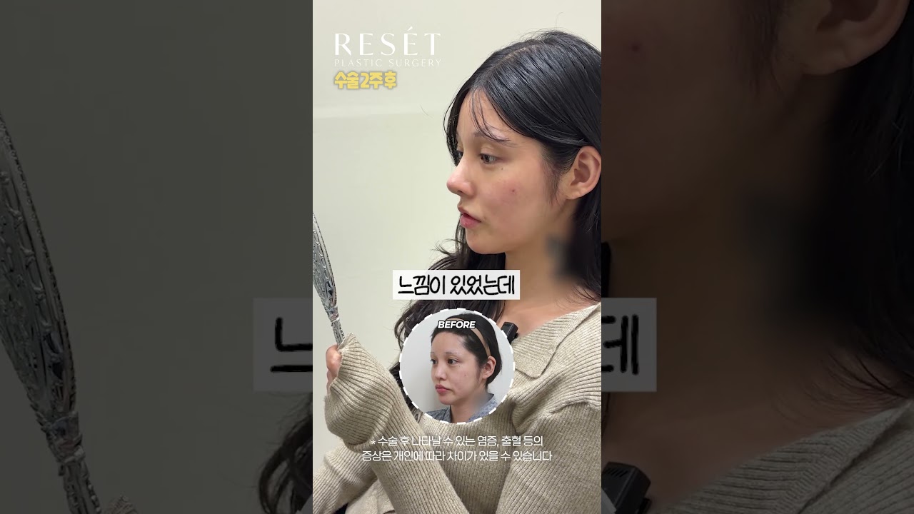 등록한썸네일