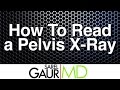 How to Read a Pelvis X-ray