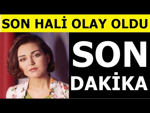 Pınar Dilşeker'in son hali tanınmaz halde!