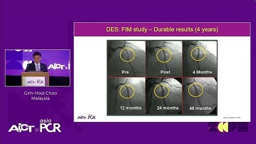 Drug-coated balloons: a PREVAIL-ing gamechanger in complex PCI - AICT-AsiaPCR 2025