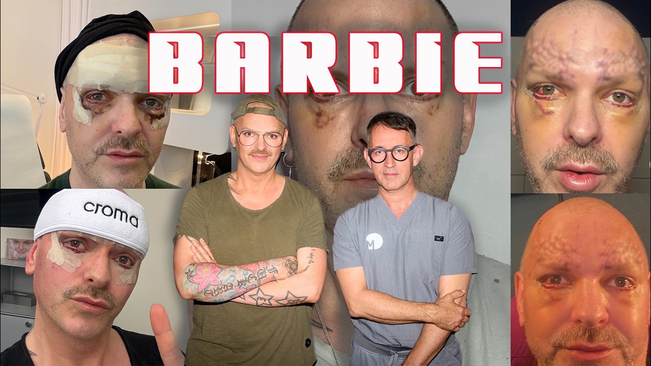 Barbie unter'm Messer: Gliding Browlift, Tränensäcke entfernen und Skin Pinch