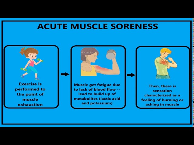 Understanding Delayed Onset Muscle Soreness (DOMS)