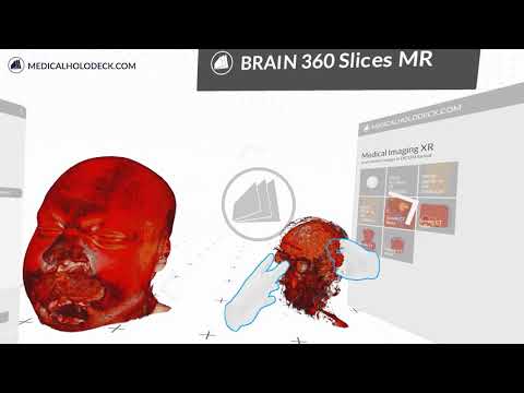 Import Dicom to Virtual Reality