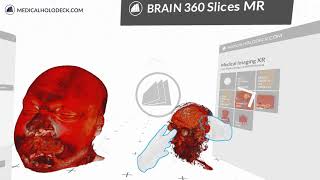 Import Dicom to Virtual Reality