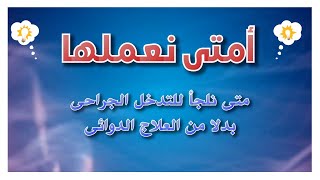 أمتى نعملها | متى نلجاء للتدخل الجراحى بدلا من العلاج الدوائى | مع الدكتور/ ايسر بسالى