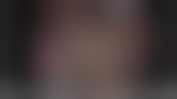 Laparoscopic left lateral sectionectomy and hepatectomy