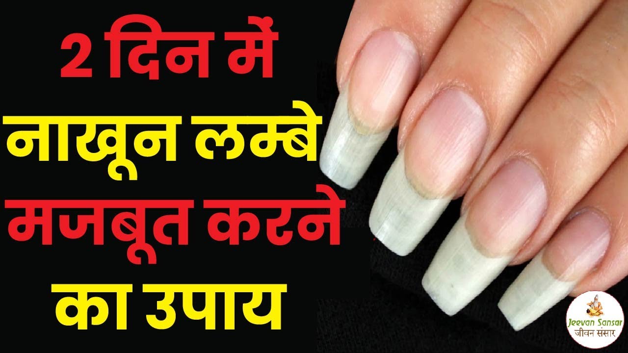 Nails and Health: सेहत का हाल भी बताते हैं नाखून, आप भी ध्यान दें इन बातों  पर - health problems due to long nails-mobile