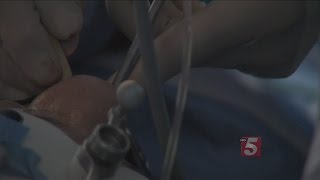 Brain Surgery Through The Nose