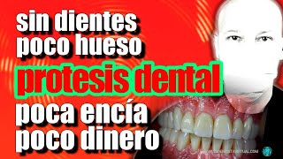 La SOLUCIÓN DEFINITIVA a los PROBLEMAS DENTALES