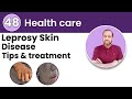 Leprosy: Understanding the Ancient Disease and Modern Solutions