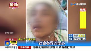 婦赴日腦出血醫療費千萬 募得700萬終返台│中視新聞 20190908