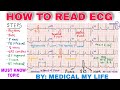 How to read an ecg