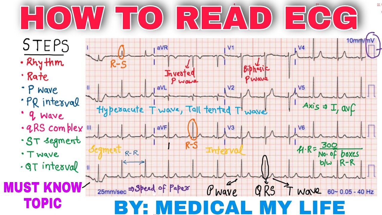 7. EKG Electrocardiogram Nail Design - wide 5