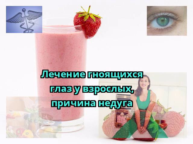 Лечение гноящихся глаз у взрослых, причина недуга