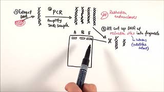 A2 Biology - DNA profiling (OCR A Chapter 21.1)