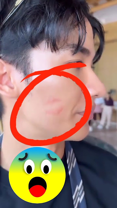 Who else kissed Tay after the case incident on live yesterday #taynew #newwiee #geminifourth