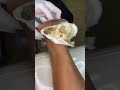 كالوس لتشقق القدم للحجز وتساب 07815585474او انستا  1002