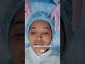 الغذاء والدواء تحذر من بوتوكس مزوّر يهدد الصحة 💉🩺