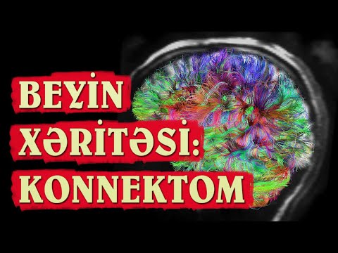 Beyin xəritəsi: Konnektom