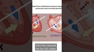 Constrictive pericarditis pathophysiology part 4 (Respiratory variation of mitral inflow)