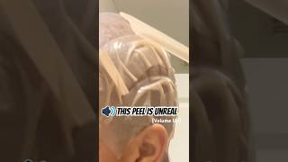 Honestly, the peel is the best part.
