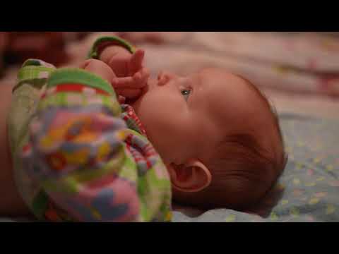 Vidéo: Quel Est Le Danger D'hémangiome Chez Un Nouveau-né