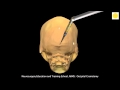 Neurosurgery 3D Animation Video : Occipital Craniotomy