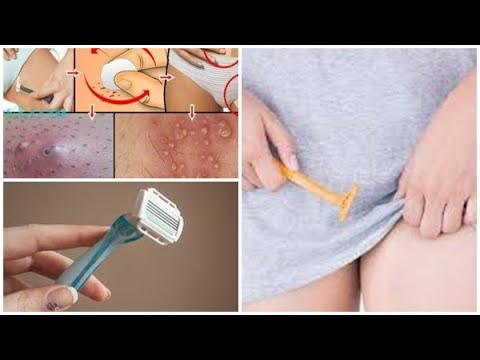 Βίντεο: Πώς να ξυρίσετε πριν από το σεξ