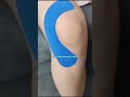 #kneepain #kneetapping #k_tapping #tapping #happynewyear #pain #physiotherapy #kneecare #knee#doctor