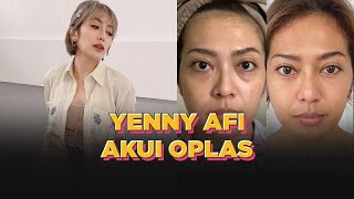 Transformasi Yenny AFI yang Jujur Akui Oplas