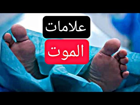 علامات الموت قبل 40 يوم 