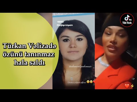 Şarkıcı Türkan Velizade tanınmaz hale geldi