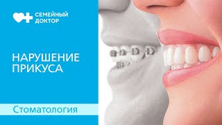 Нарушение прикуса. На что это влияет?