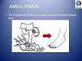 Ankle MRI 2: Ankle Sprain